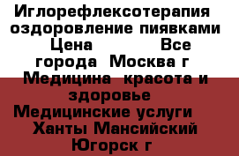 Иглорефлексотерапия, оздоровление пиявками › Цена ­ 3 000 - Все города, Москва г. Медицина, красота и здоровье » Медицинские услуги   . Ханты-Мансийский,Югорск г.